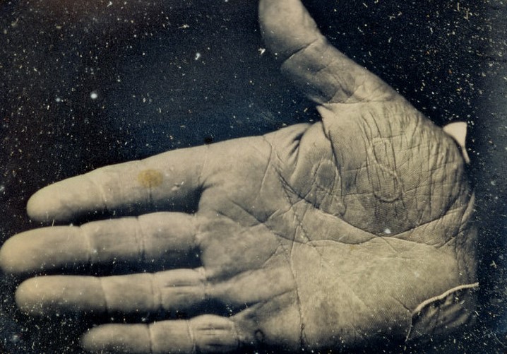 Close-up image of an aged, weathered hand with visible creases and lines.